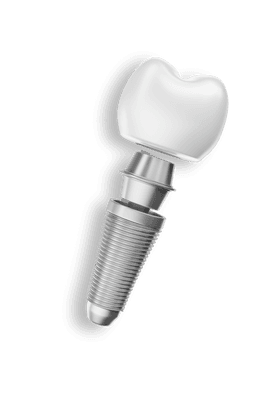 Dente Implante