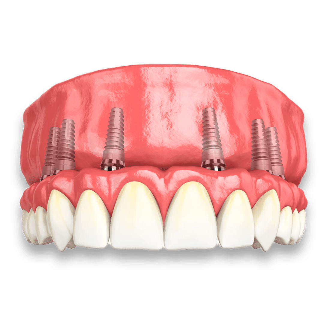 Protocolo (Arco Completo)